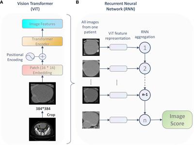 Preoperative CT-based deep learning model for predicting overall survival in patients with high-grade serous ovarian cancer